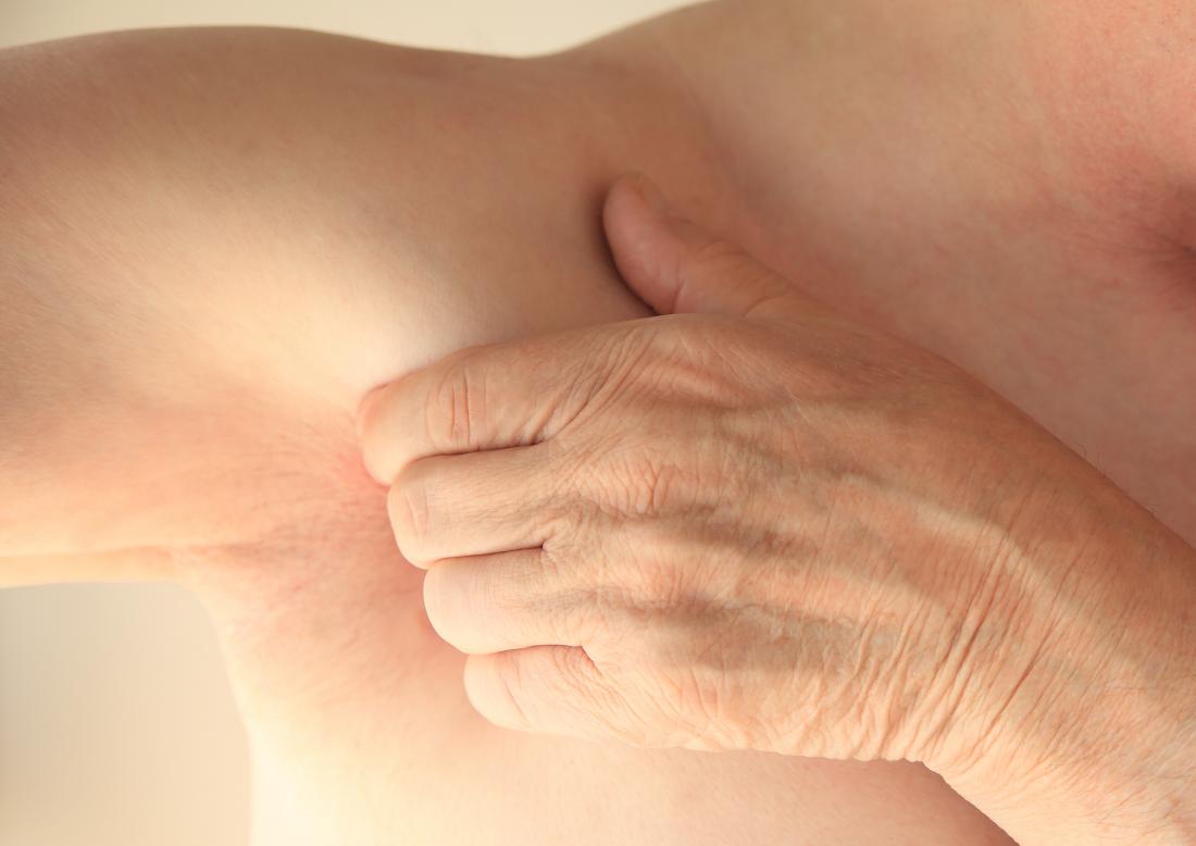 уплотнение в области груди у женщин фото 108