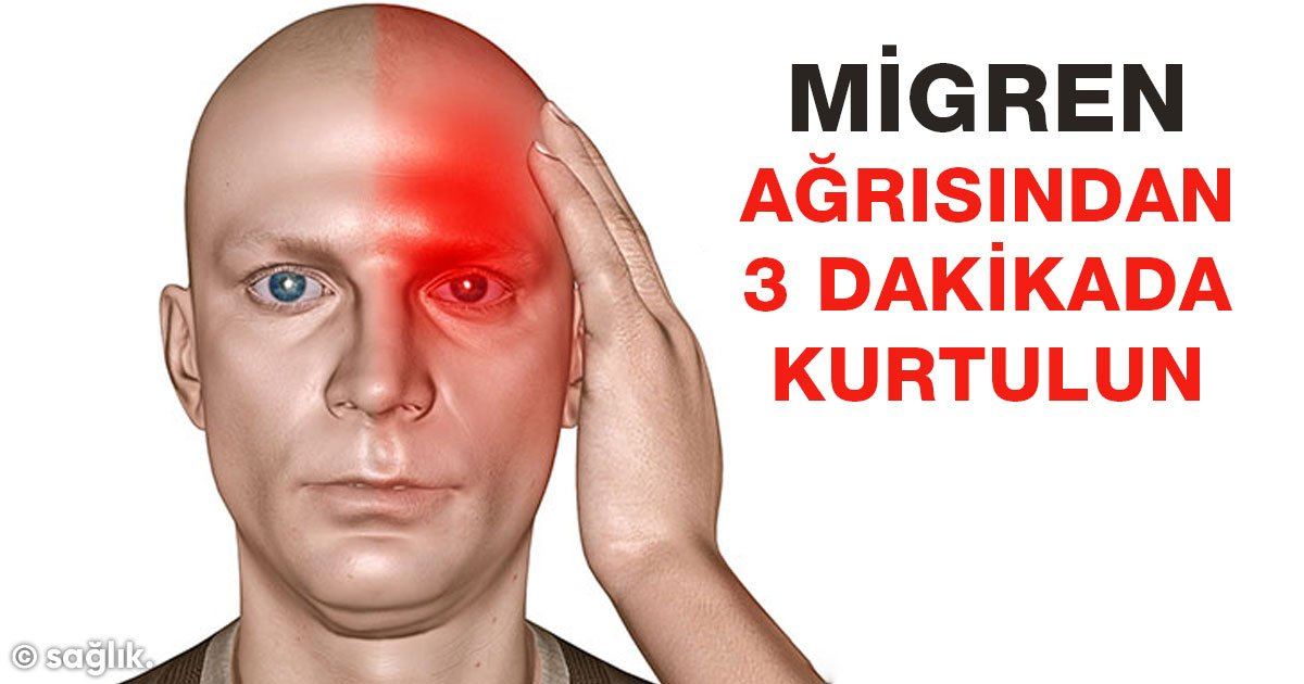 migren ağrısı